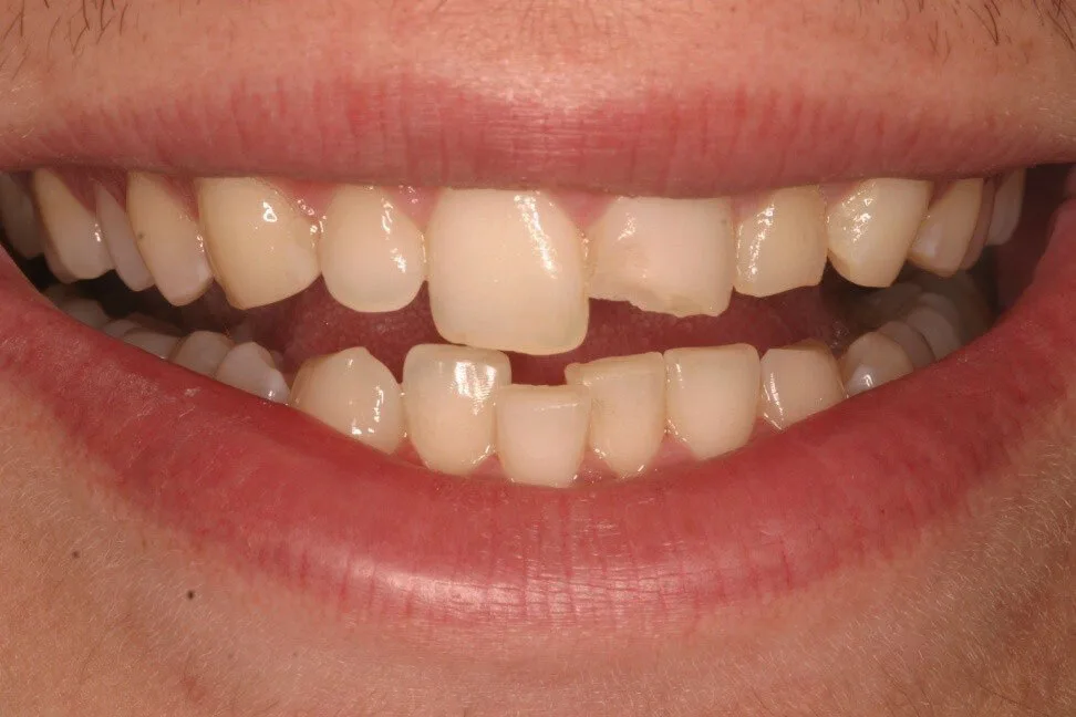 Patient 2 before treatment