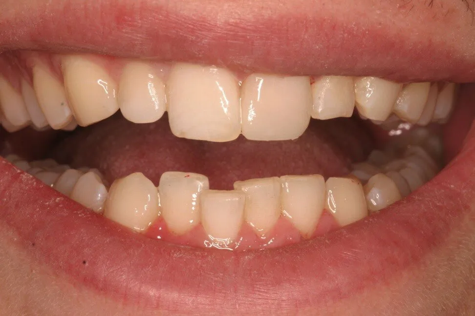 Patient 2 after treatment