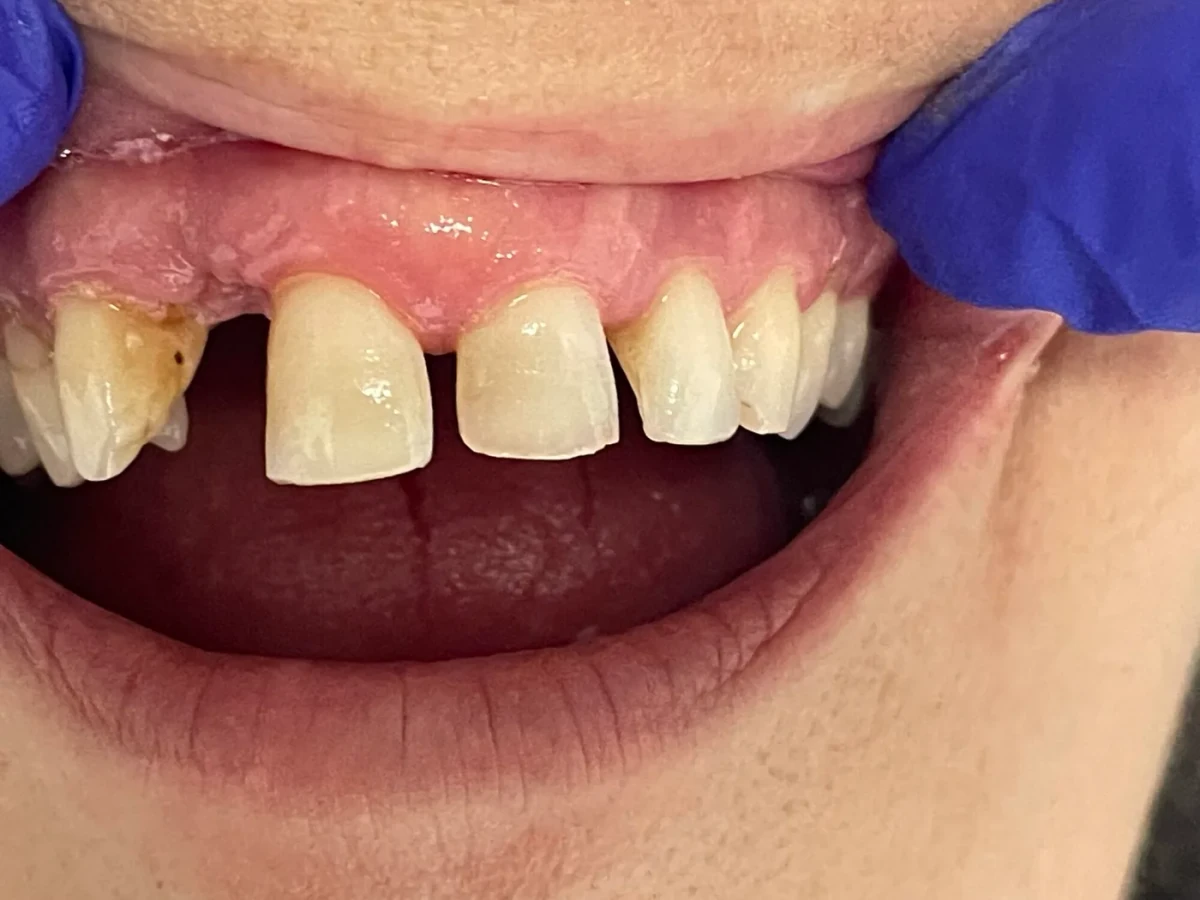 Patient 7 before treatment, first view