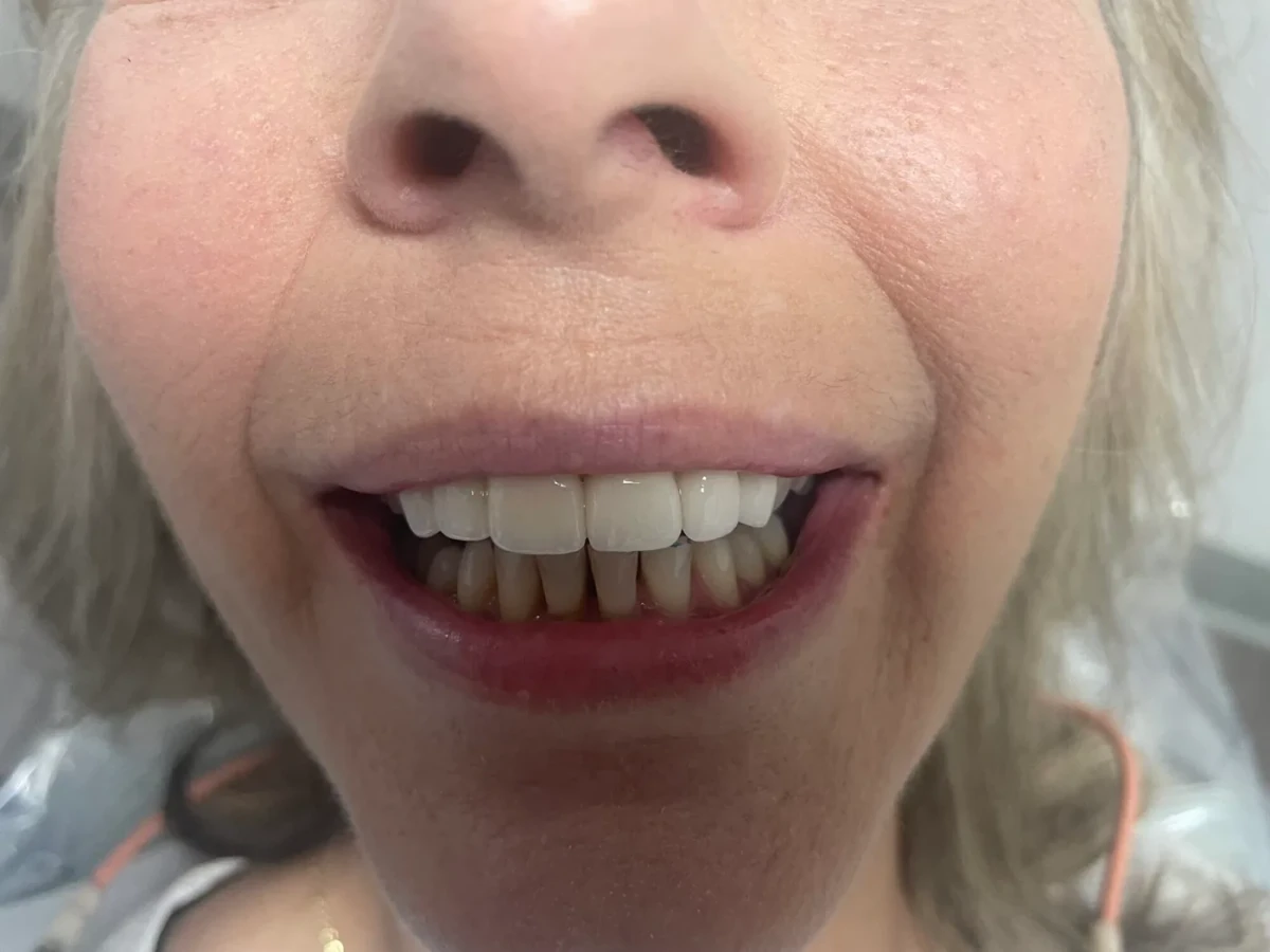 Patient 7 after treatment
