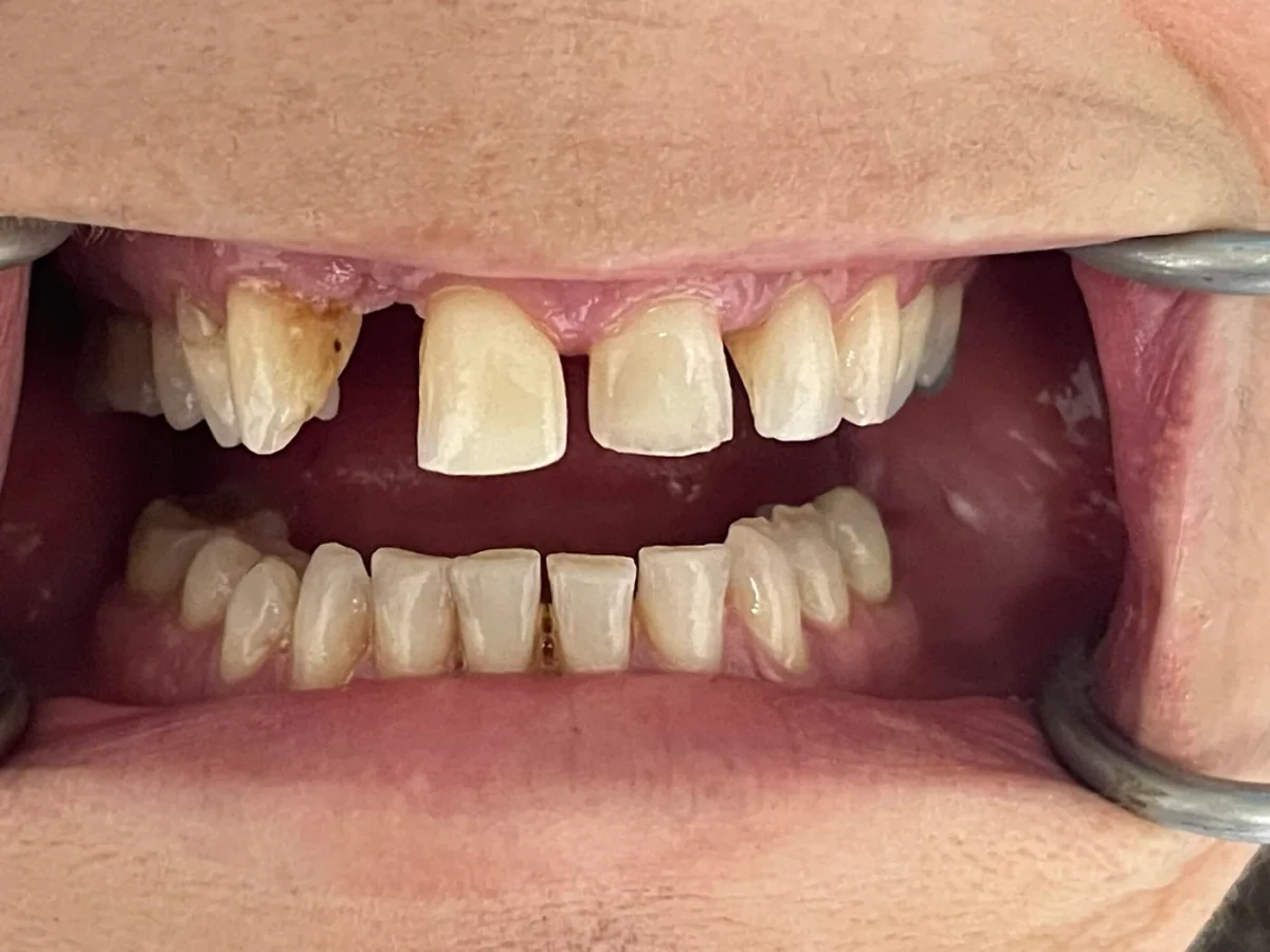Patient 7 before treatment, second view